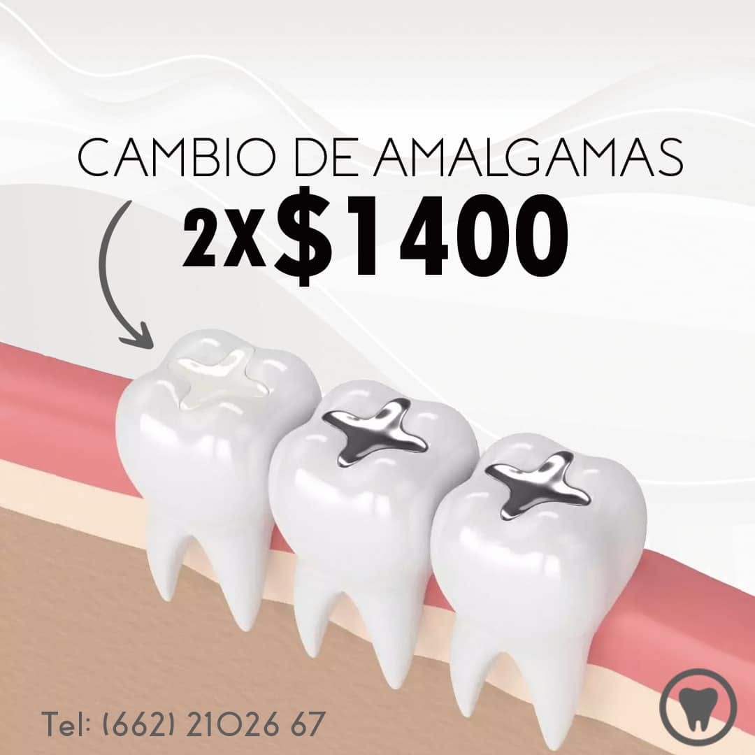 Promo amalgamas 2x1400