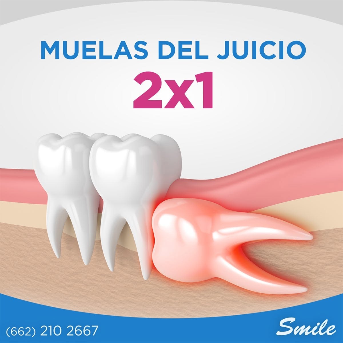 Promo muelas del juicio 2x1